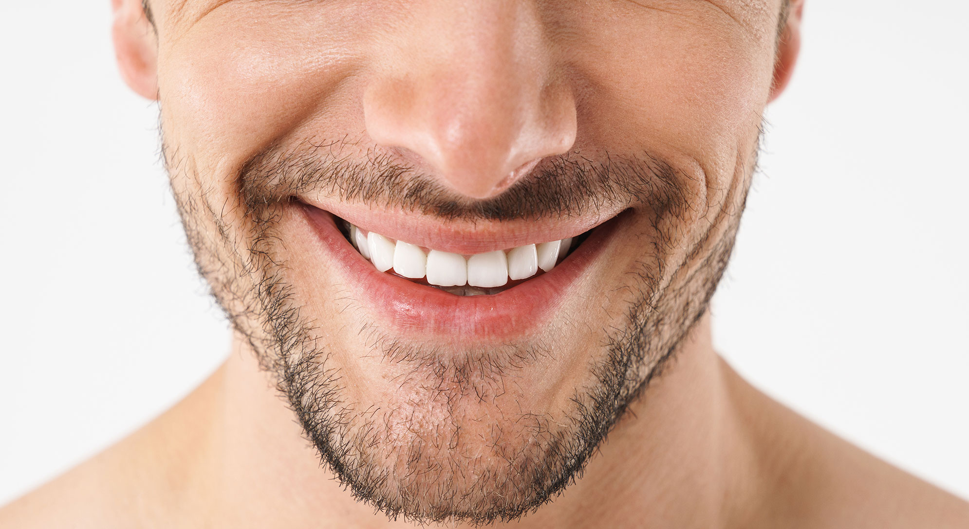 Woman with teeth whitening