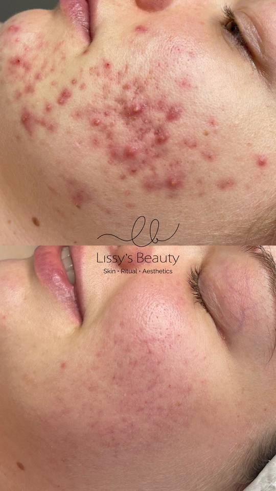 Client skin progress 9