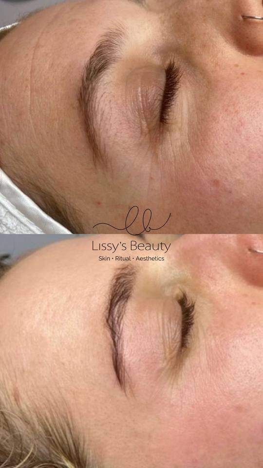 Client skin progress 4