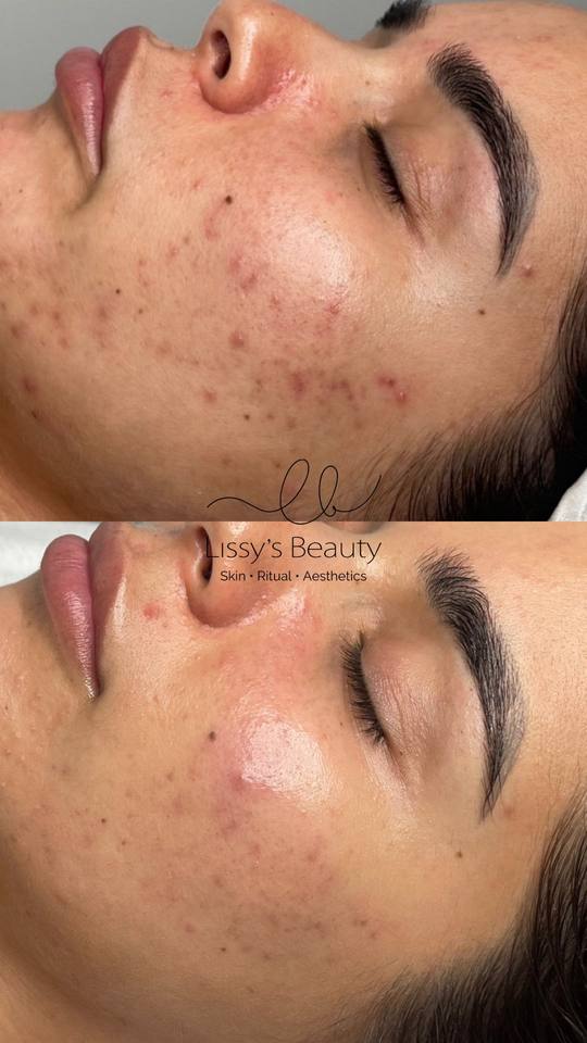 Client skin progress 10