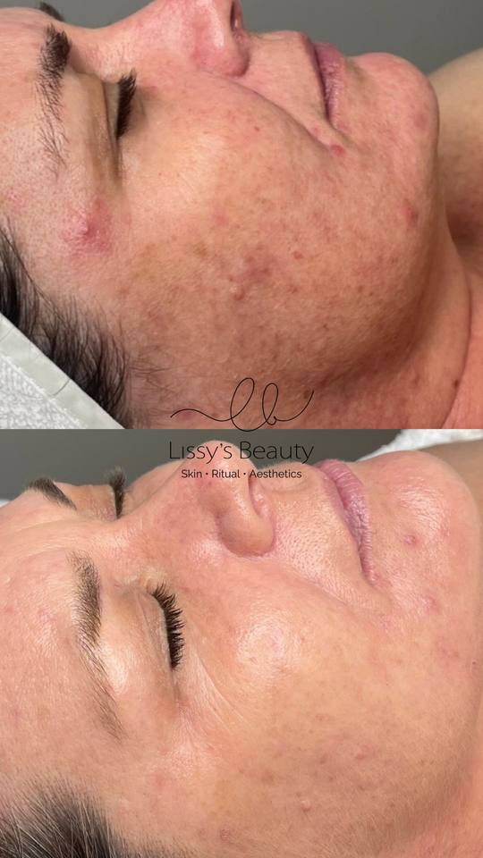 Client skin progress 12