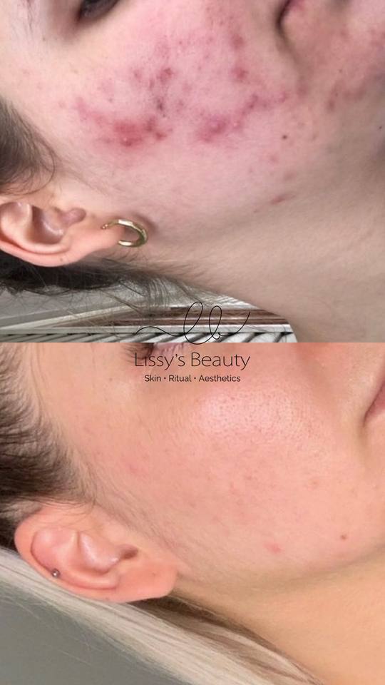 Client skin progress 7