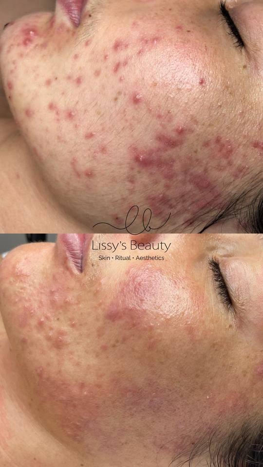 Client skin progress 8