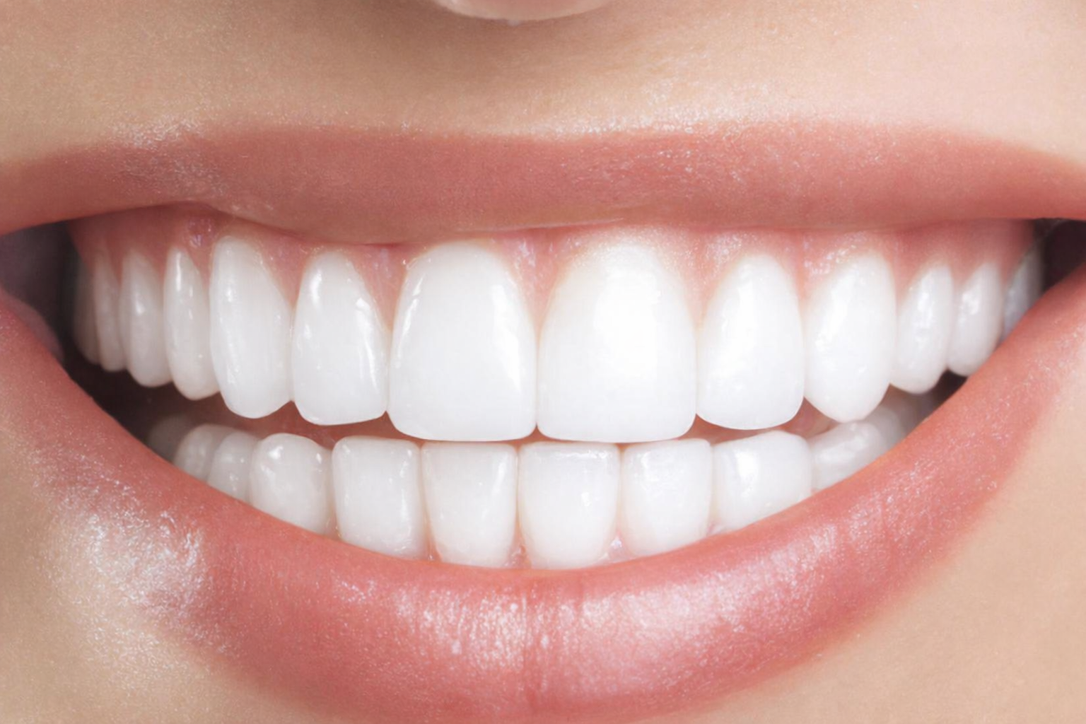 Après blanchissement