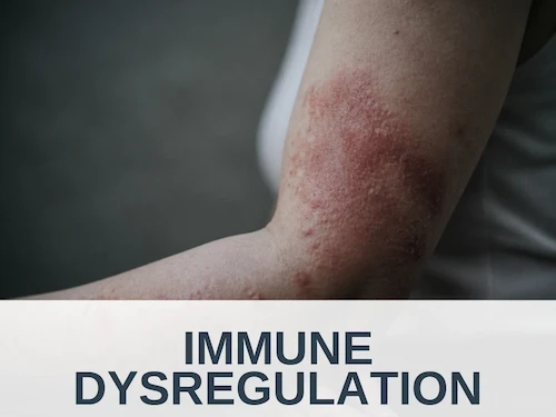 Immune Dysregulation