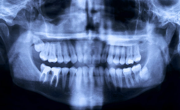 What to expect during your dental visit