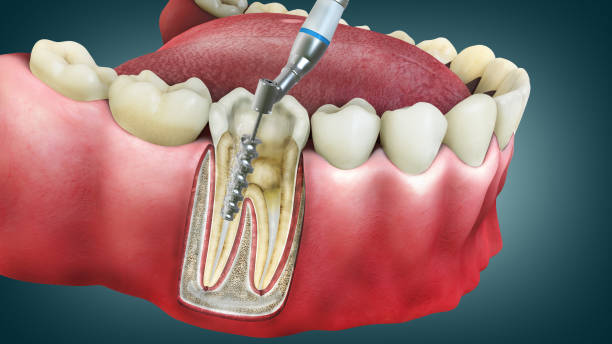 What to expect during your dental visit