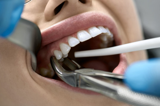 What to expect during your dental visit