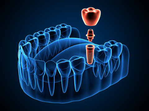 Who this dental service is for