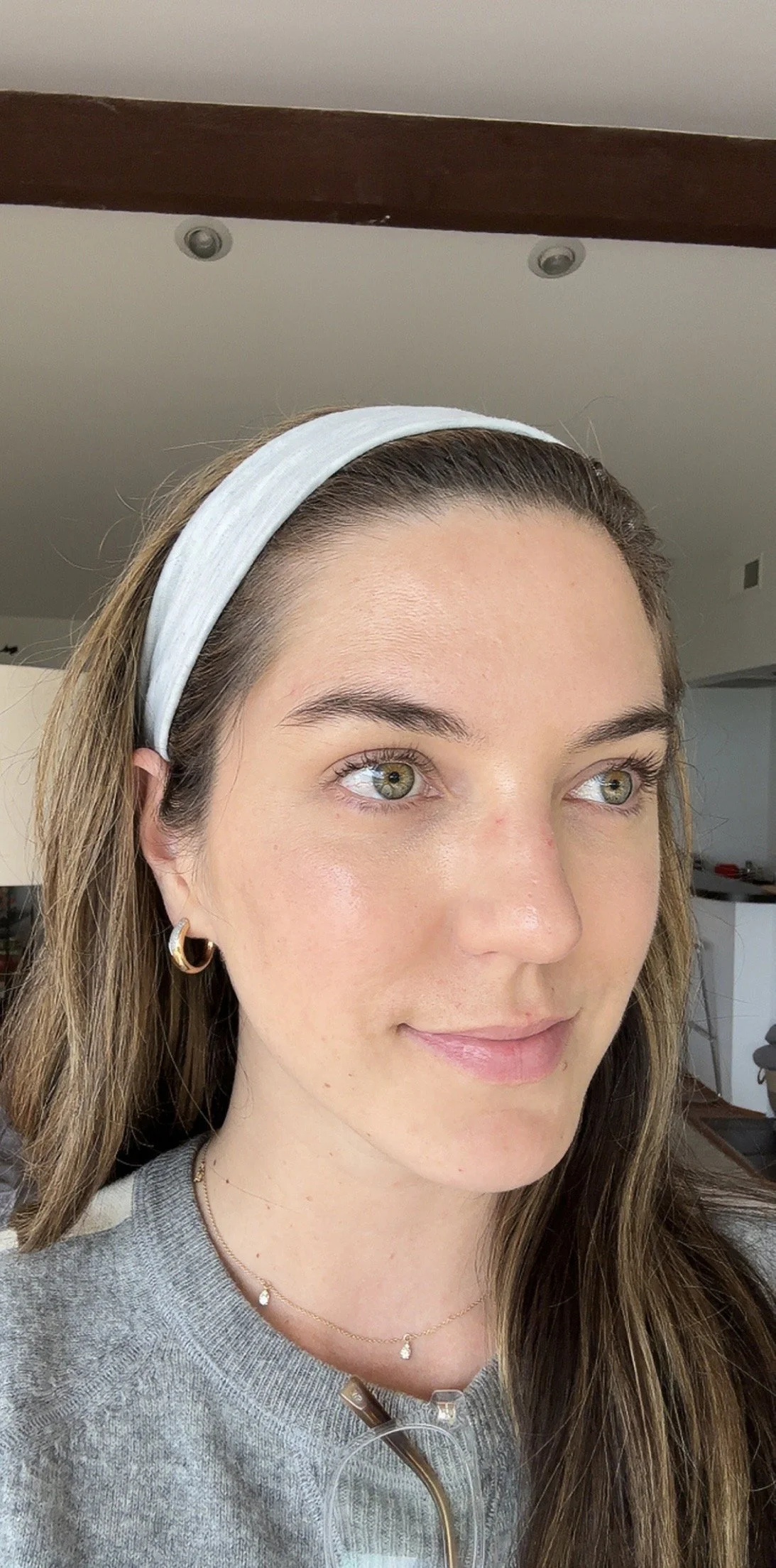 Delaney's skin, after