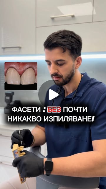 Видео: естетика с керамични фасети