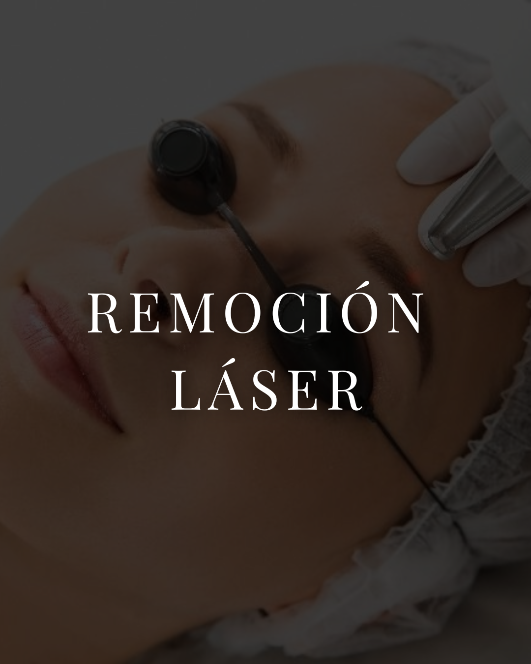 Despigmentación Láser