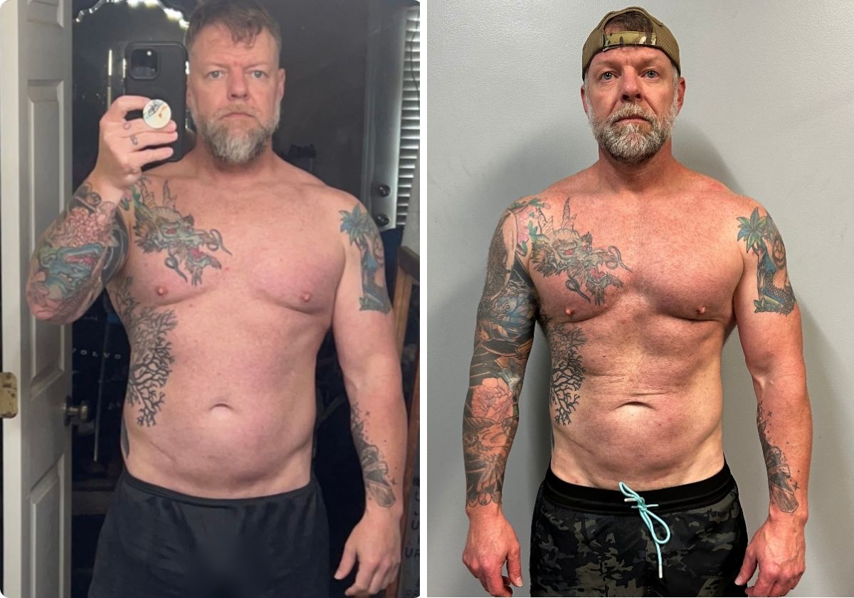 Robert before and after