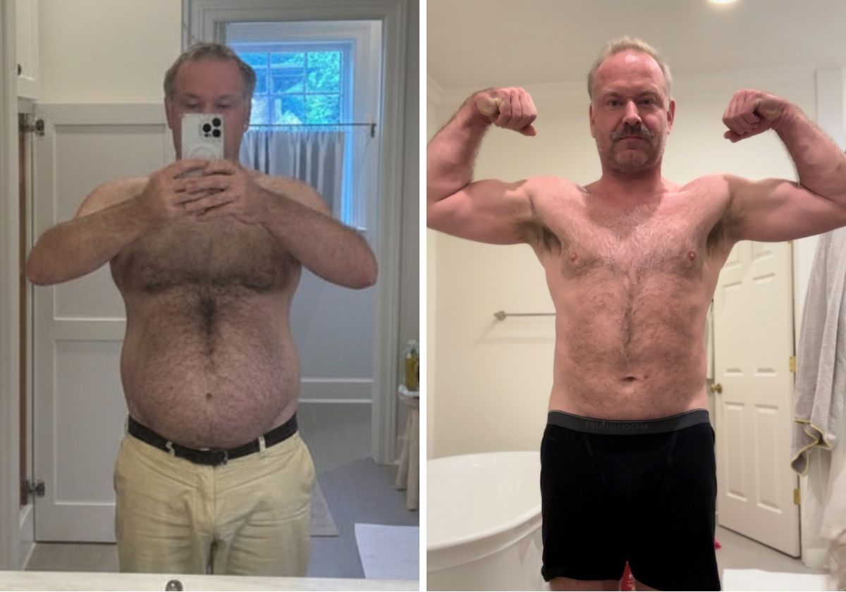 Jamie before and after