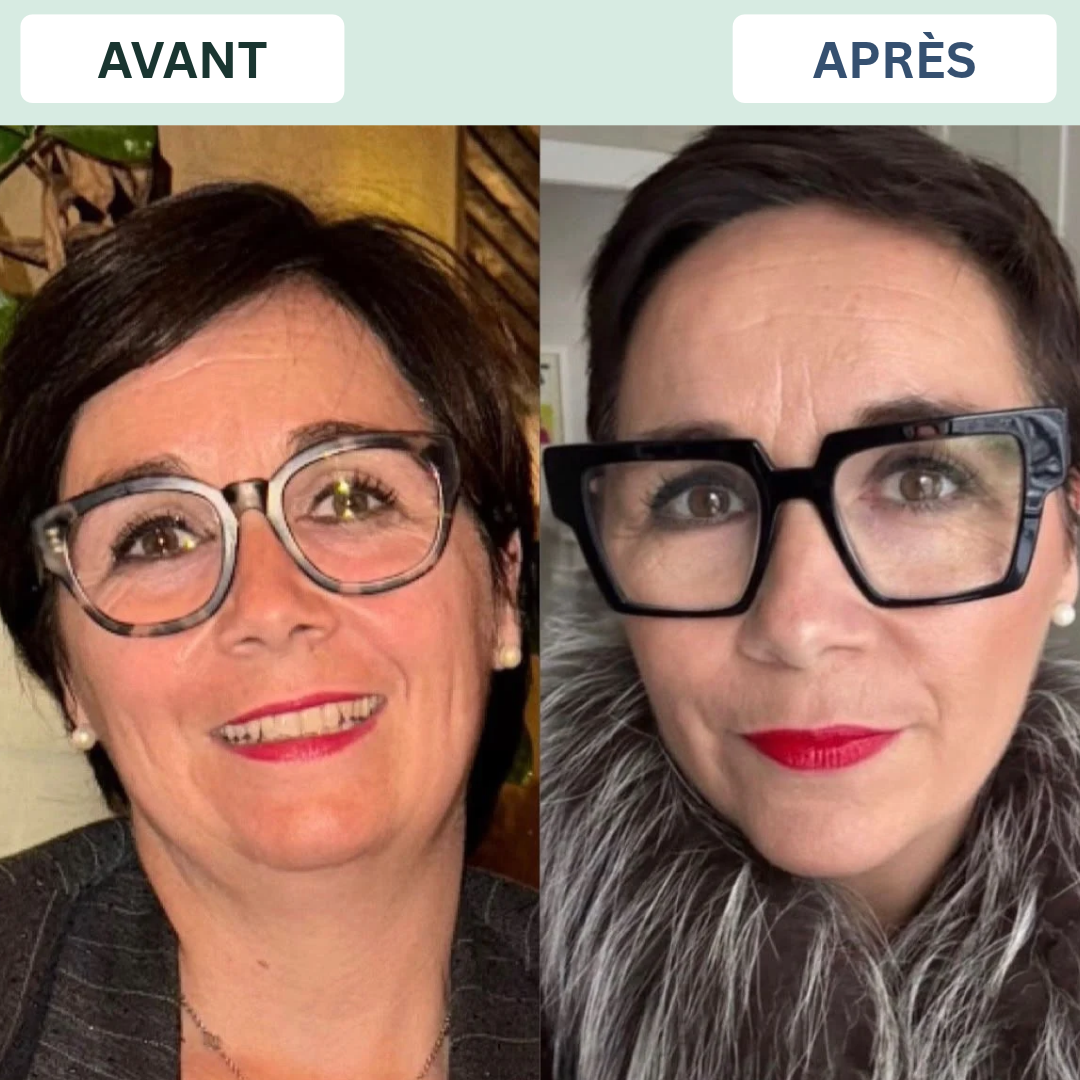 Géraldine Lerch — Avant et Après