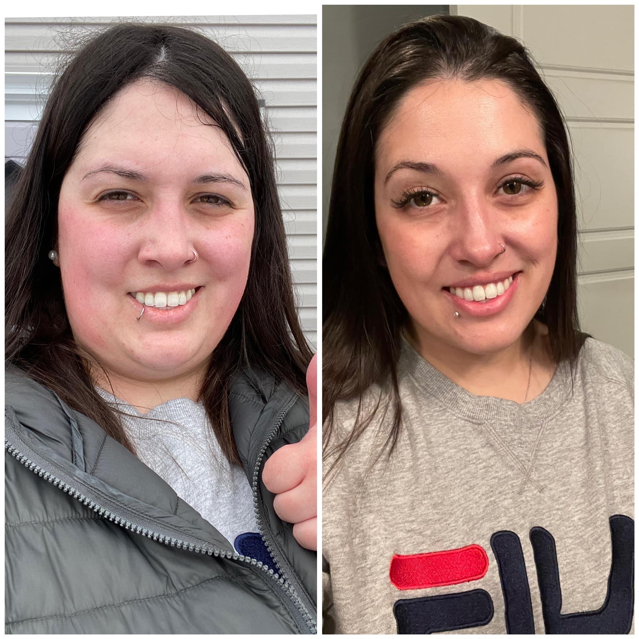 Transformation avant-après
