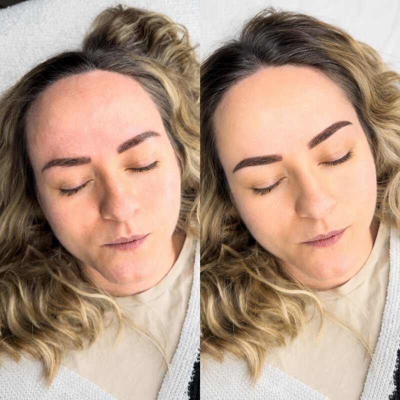 Resultado real de micropigmentación de cejas, caso 6