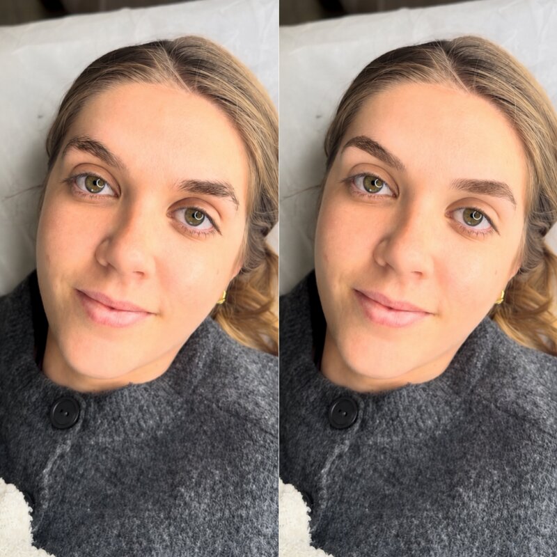 Resultado real de micropigmentación de cejas, caso 8