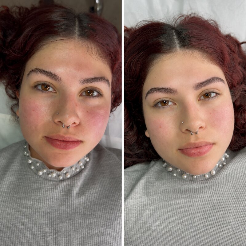 Resultado real de micropigmentación de cejas, caso 2