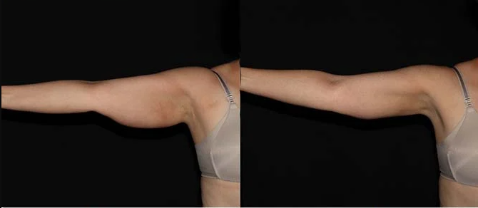 Client result example
