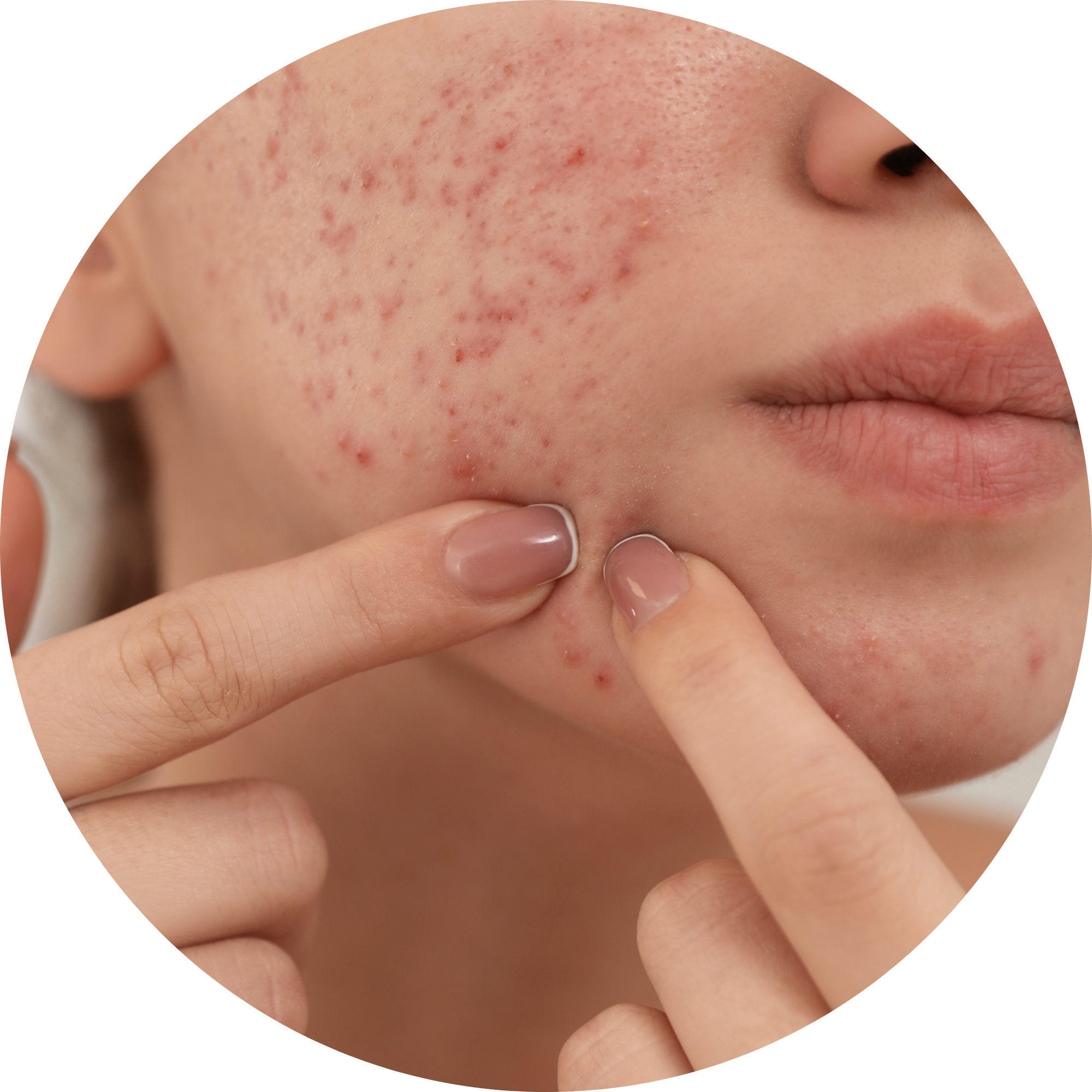 Skin Problems