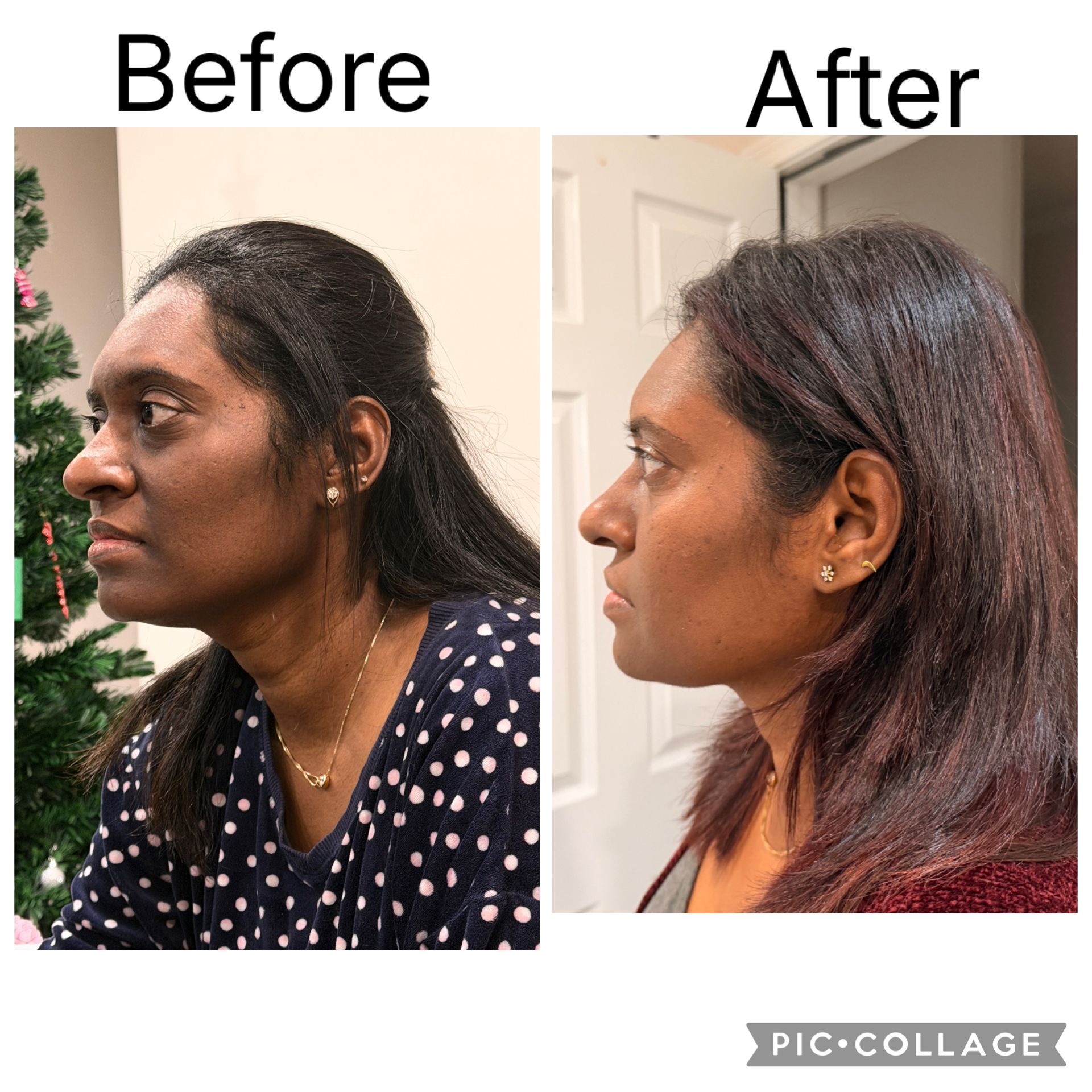 Pigmentation before & after