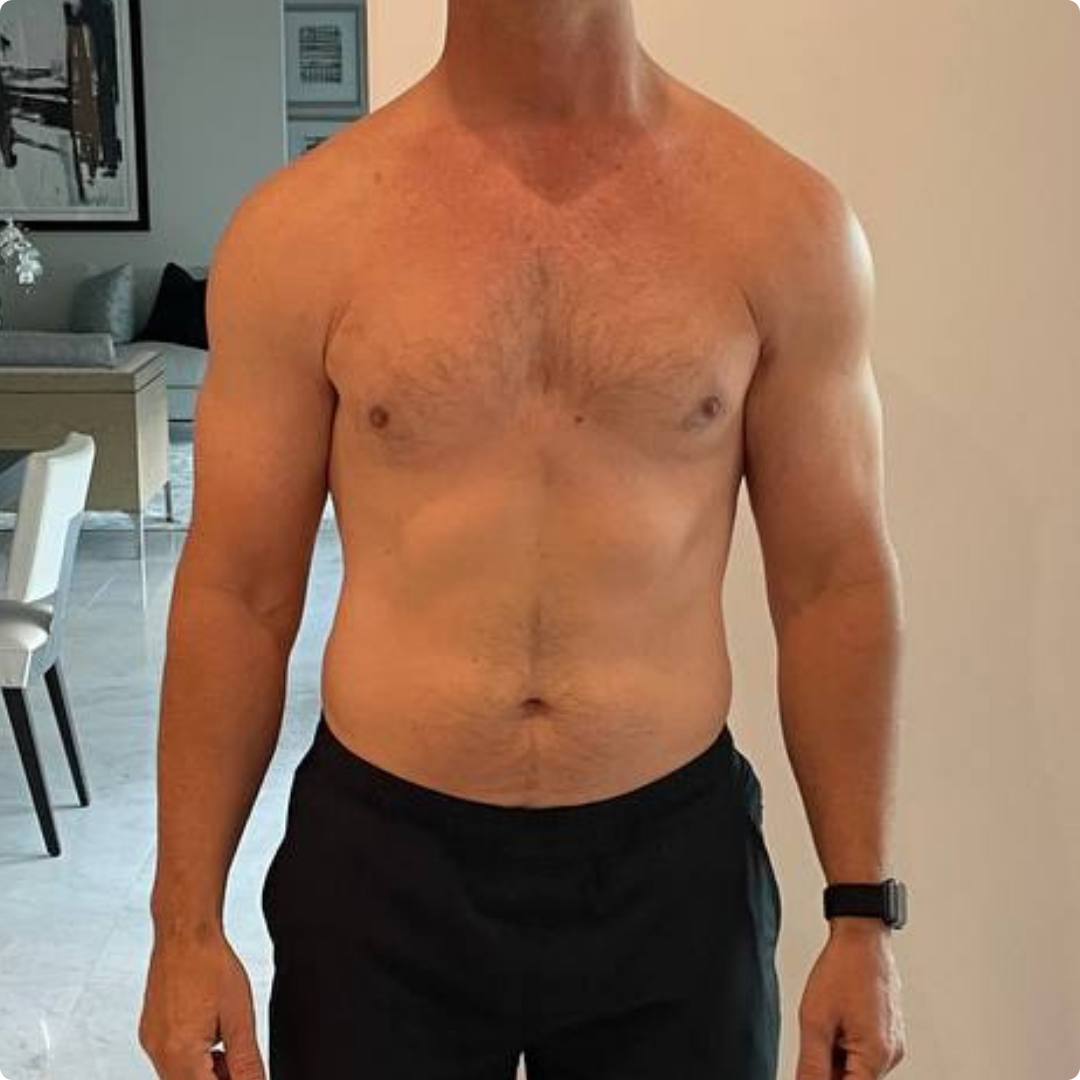 Strong Standard Client transformation before