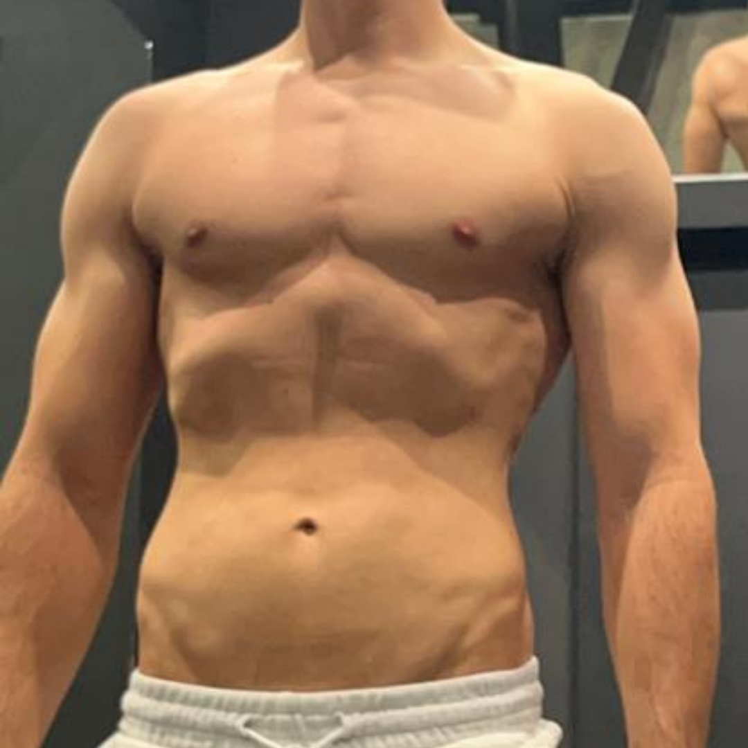 Strong Standard Client transformation after