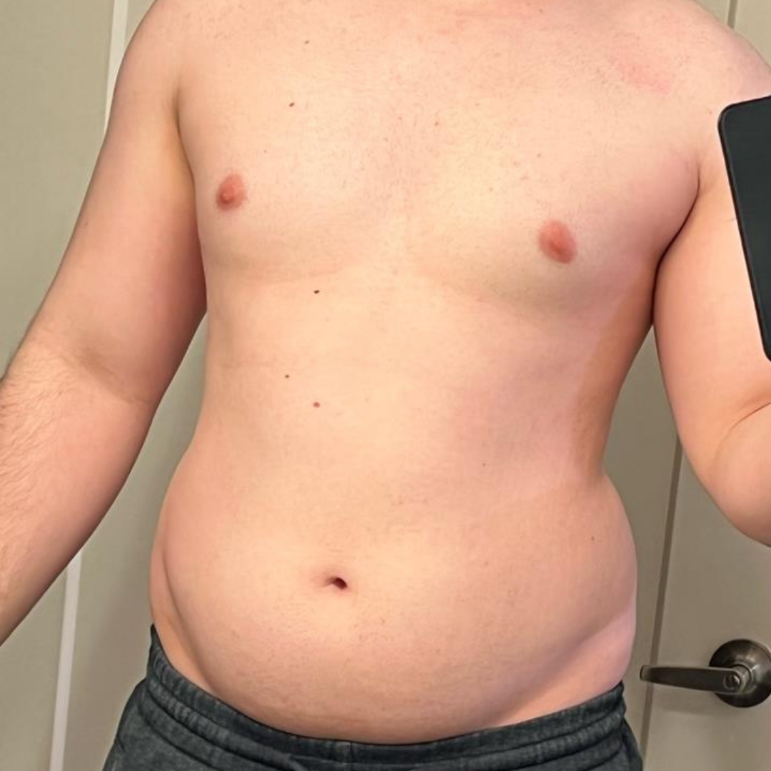 Strong Standard Client transformation before