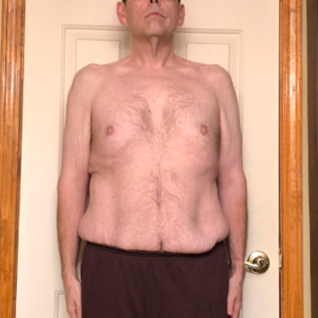 Rob Johnson after