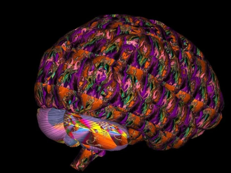 Why Change Feels So Hard - The Biology Behind Self-Sabotage