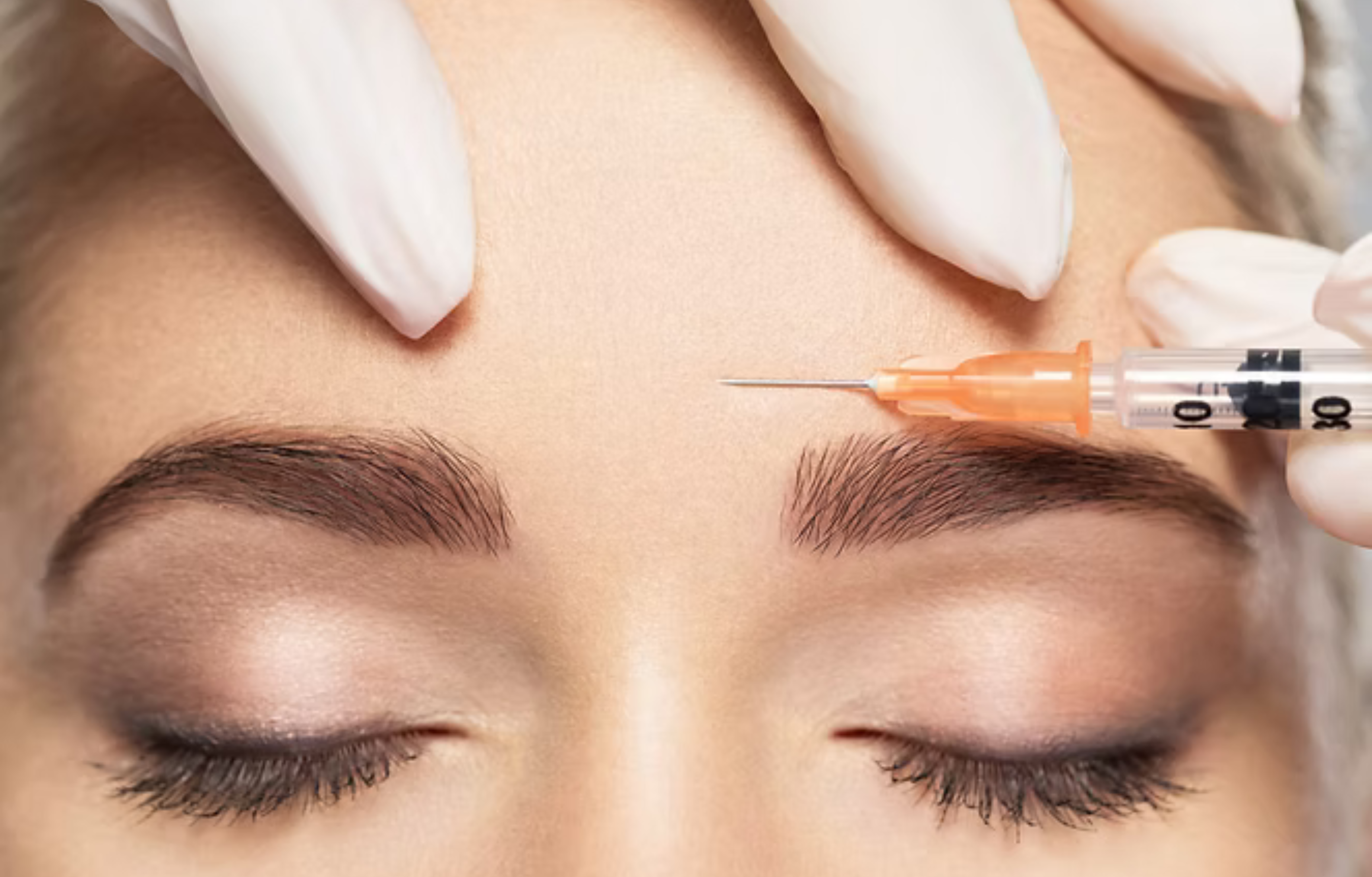 Neurotoxin injection near brow area
