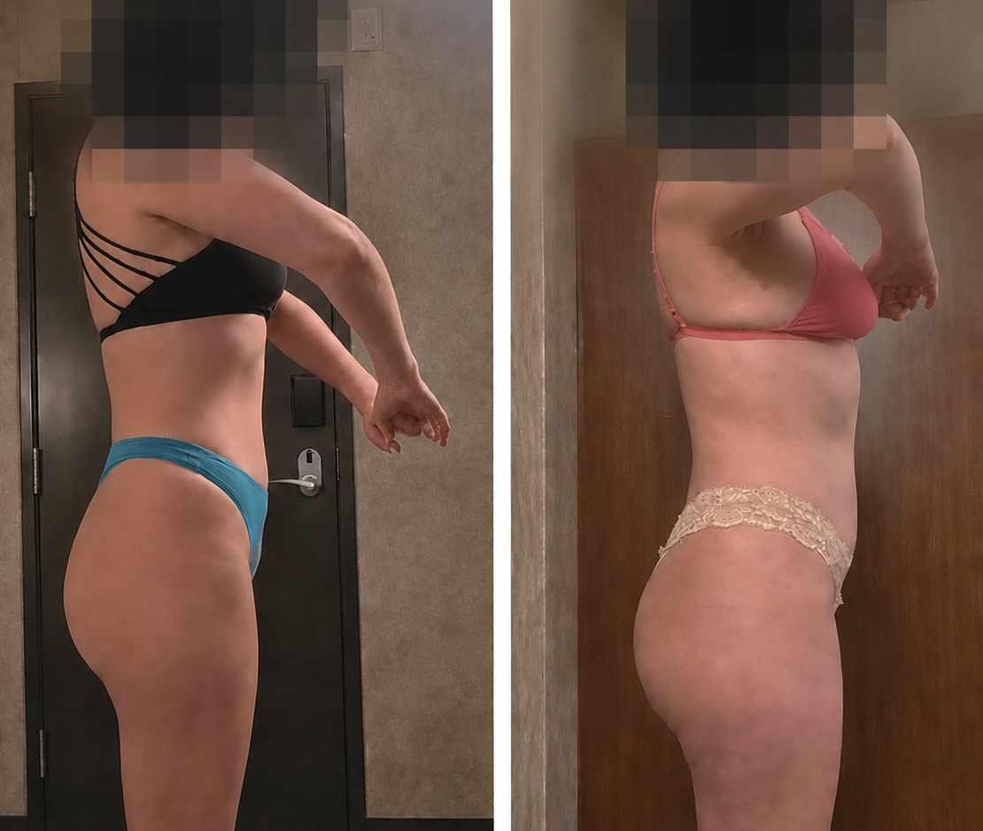Before and after gut reset result 1