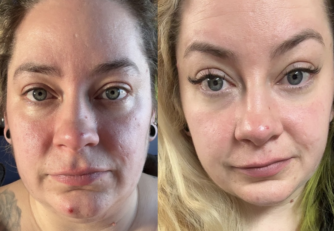 Before and after gut reset result 3