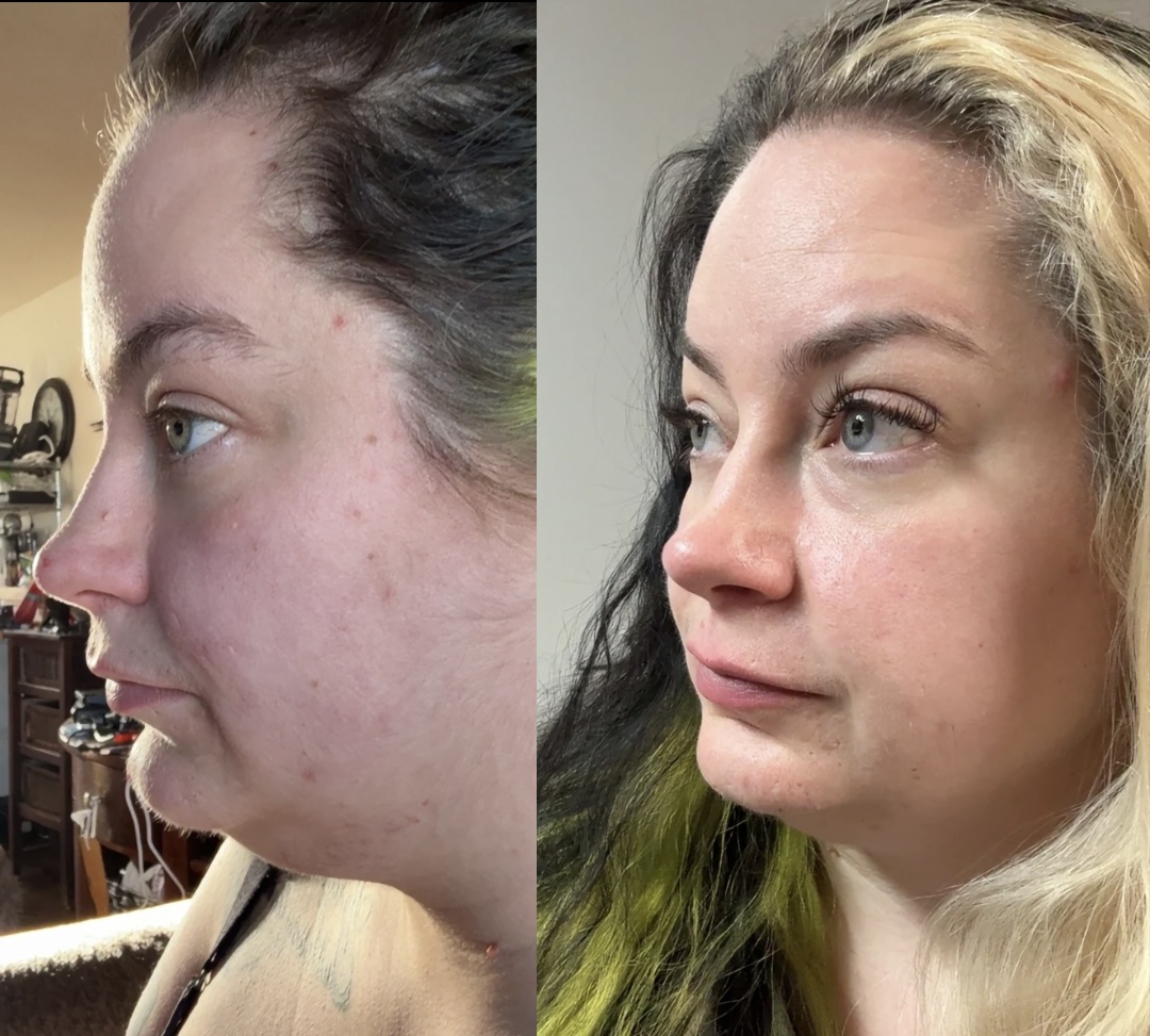 Before and after gut reset result 4