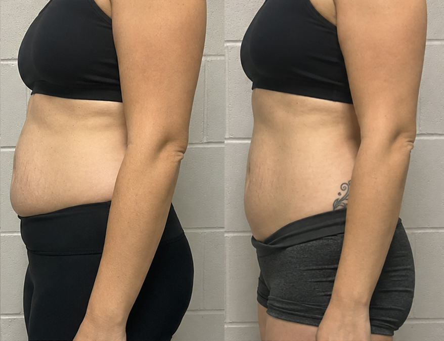 MG Wellness patient results