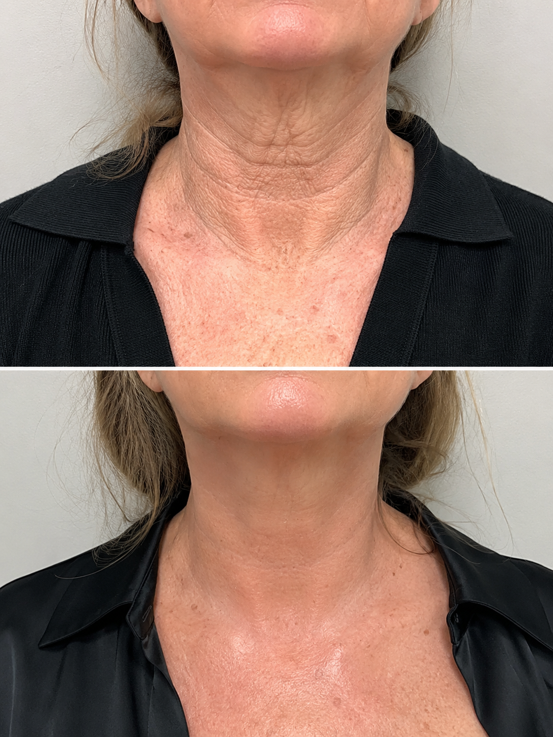 MG Wellness patient results