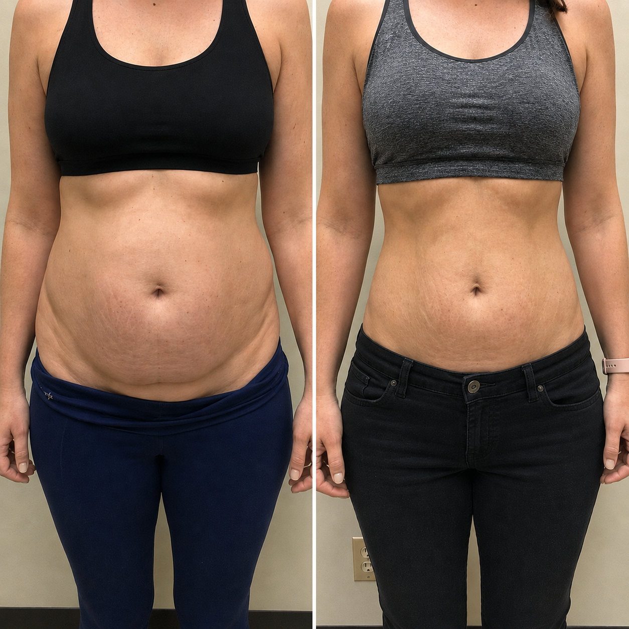 MG Wellness patient results
