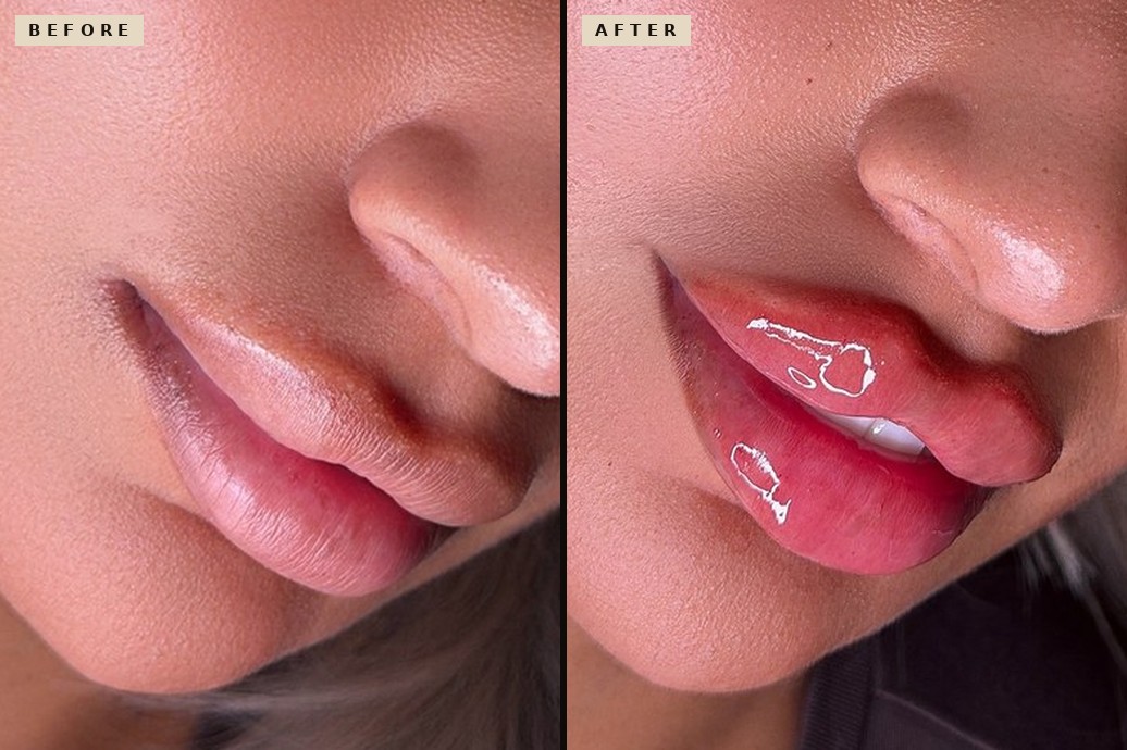 Russian Lips before and after