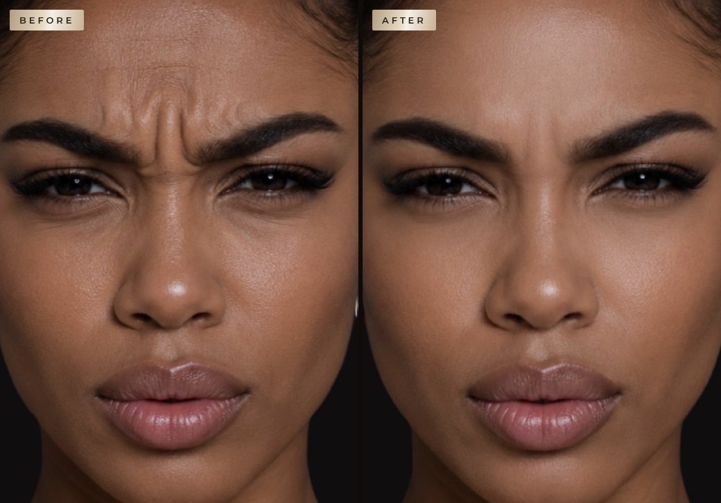 Tox before and after