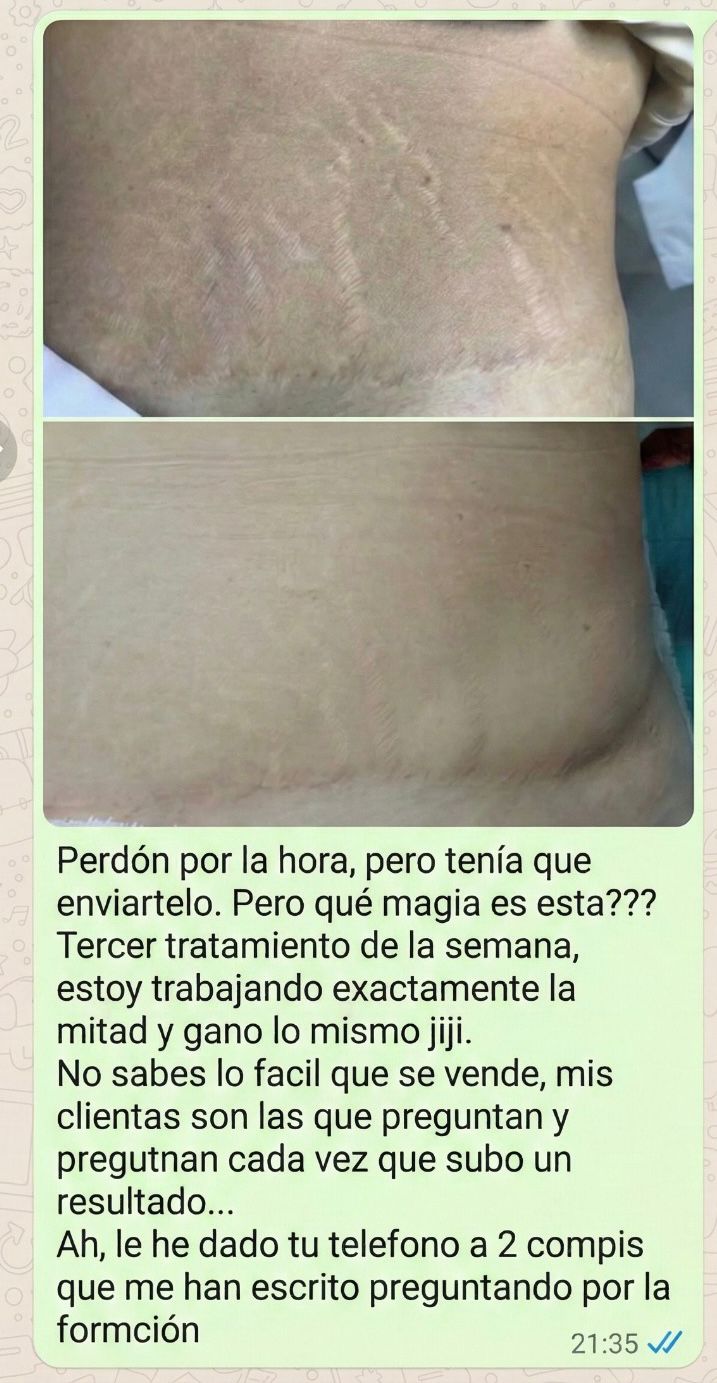 Testimonio STRIORT