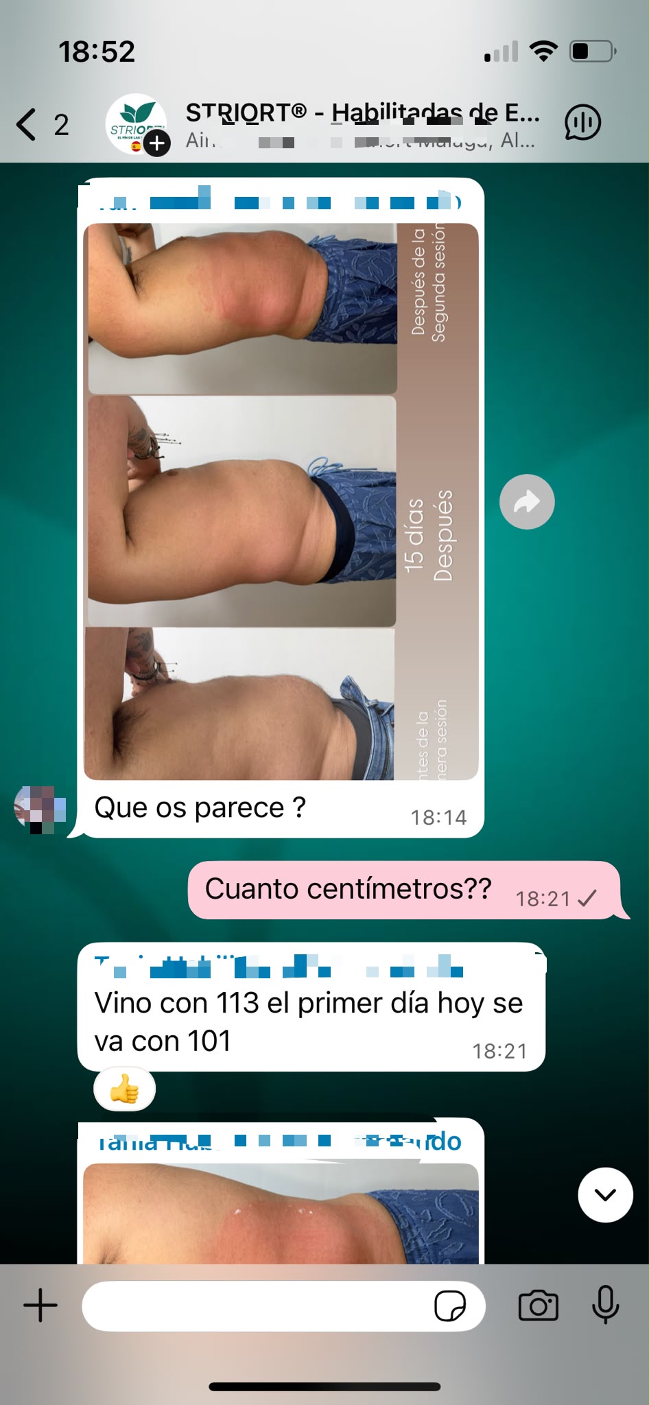 Resultado STRIORT antes/después