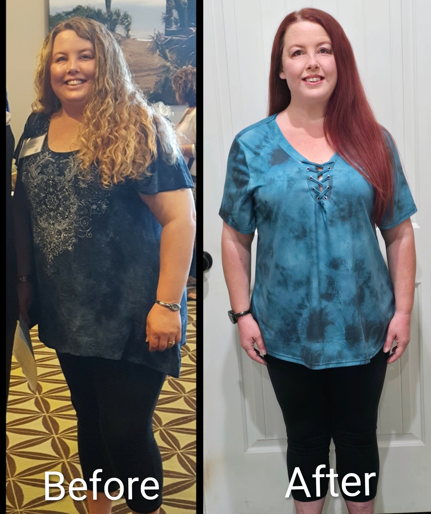 Mindy Alexander Before and After