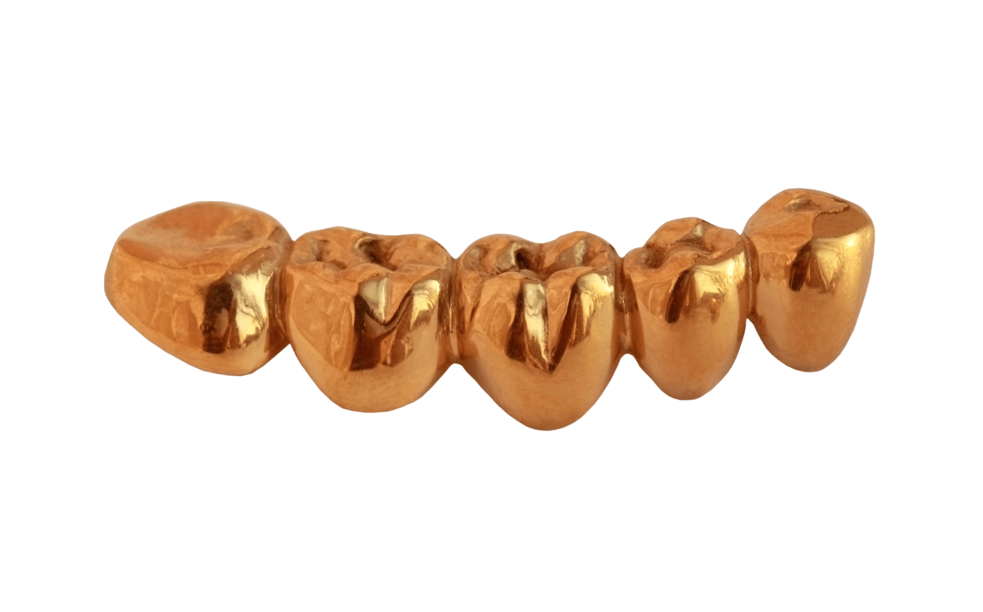 Golden Teeth