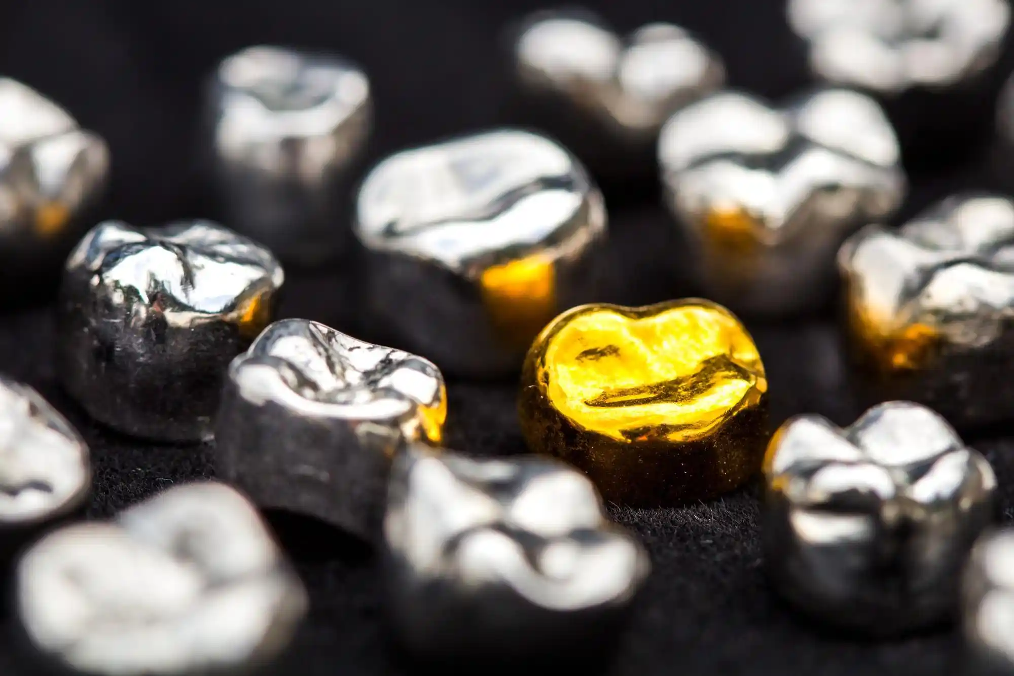 Precious Metal Dental Pieces