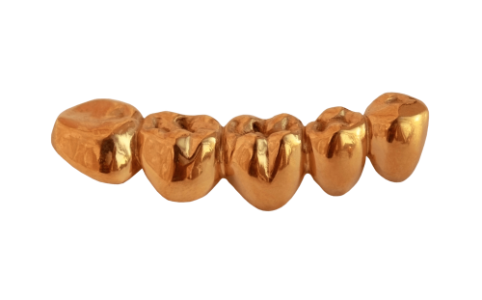 Golden Teeth