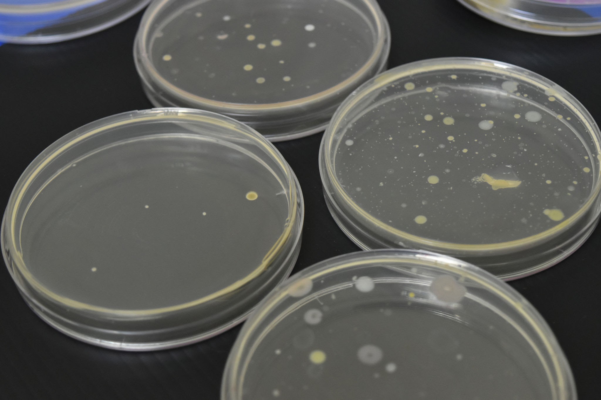 Progression of a beginner microbiology safe home lab from initial swabs to diverse colony observation in a home setting.