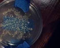 Results of a beginner microbiology experiment at home comparing a sanitized surface to an unwashed thumb on nutrient agar plates