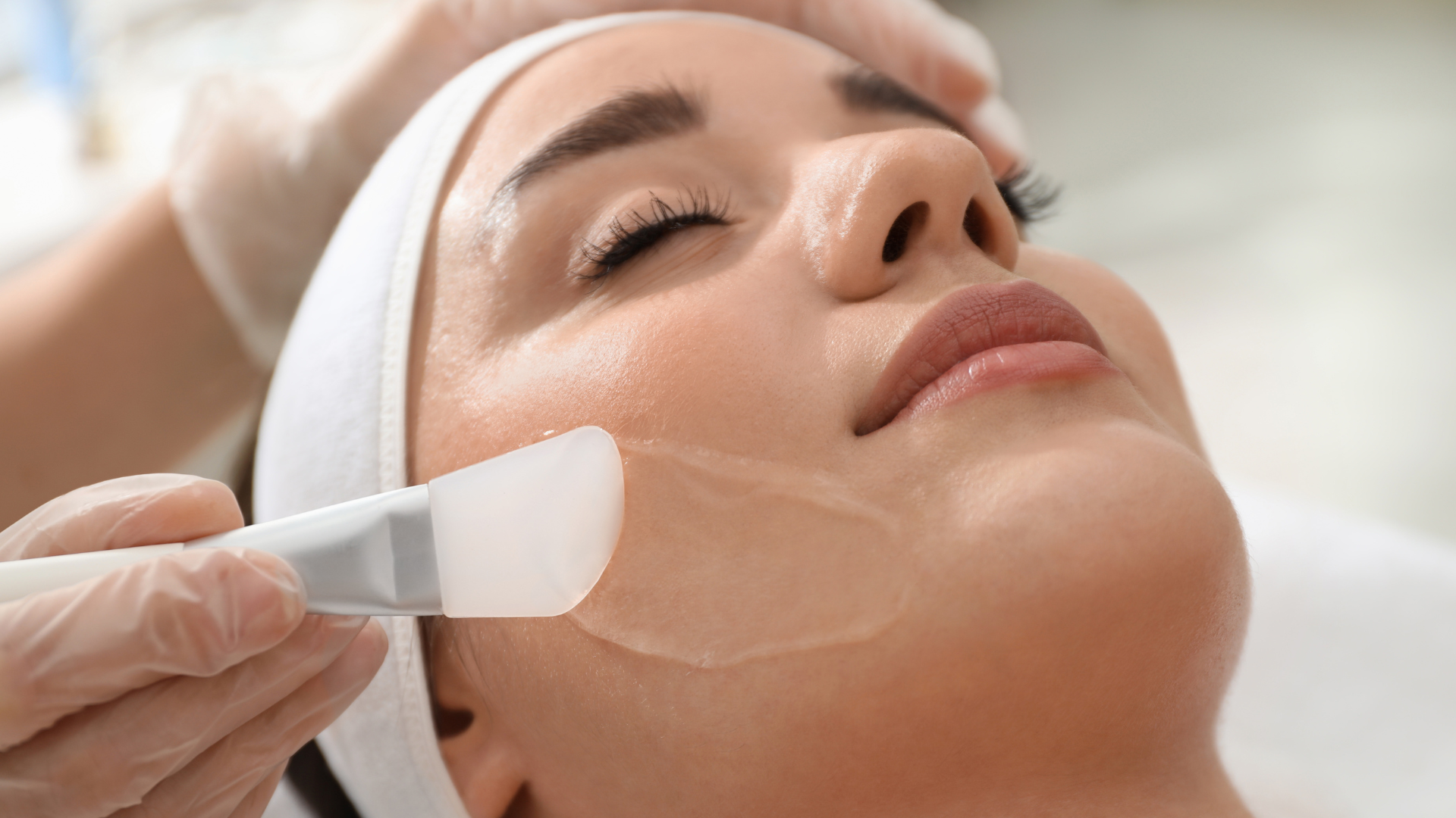 Chemical peel