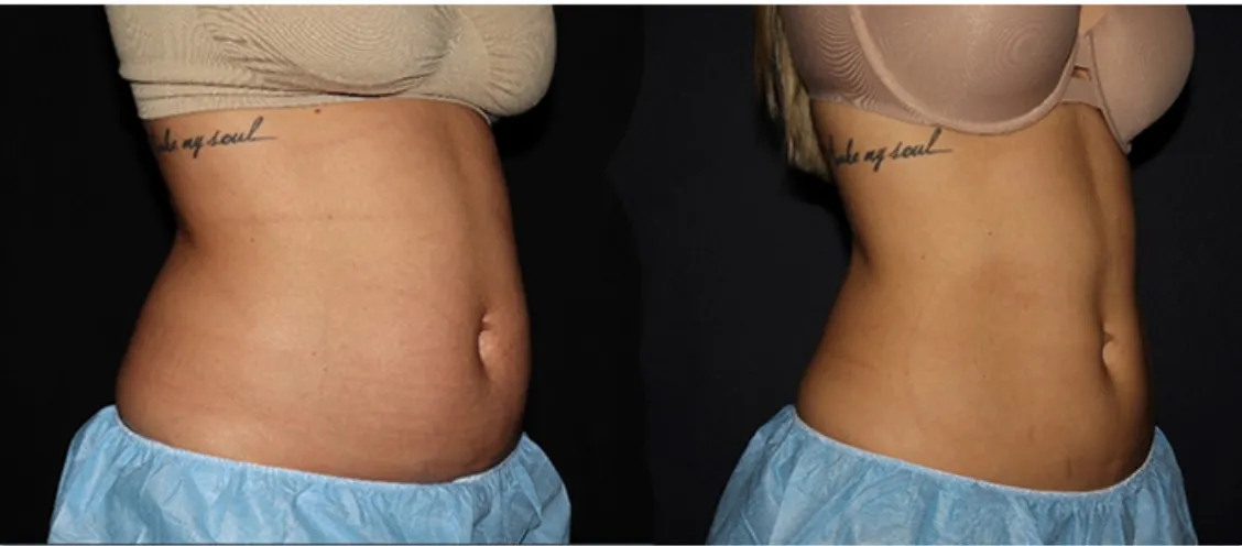 Client result example